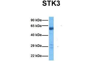 Western Blotting (WB) image for anti-serine/threonine Kinase 3 (STK3) (C-Term) antibody (ABIN2783469)