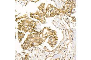 Immunohistochemistry (IHC) image for anti-Catenin (Cadherin-Associated Protein), beta 1, 88kDa (CTNNB1) antibody (ABIN7266138)