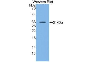 Western blot analysis of the recombinant protein. (F13A1 抗体  (AA 372-616))
