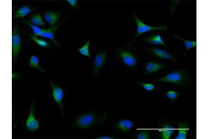 Immunofluorescence of purified MaxPab antibody to DIAPH1 on HeLa cell. (DIAPH1 抗体  (AA 1-404))