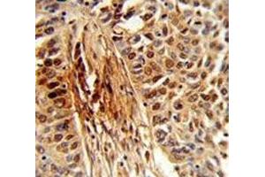 Immunohistochemistry (IHC) image for anti-Peptidylprolyl Cis/trans Isomerase, NIMA-Interacting 1 (PIN1) (AA 30-56) antibody (ABIN3028920)