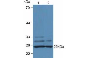 Western blot analysis of (1) Mouse Heart Tissue and (2) Mouse Liver Tissue. (C1QA 抗体  (AA 23-245))