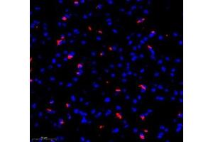 Immunofluorescence of paraffin embedded mouse brain using MAP7 (ABIN7074621) at dilution of 1:400 (300x lens) (MAP7 抗体)
