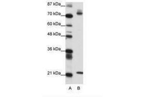 Image no. 1 for anti-SATB Homeobox 1 (SATB1) (AA 611-660) antibody (ABIN6736150) (SATB1 抗体  (AA 611-660))