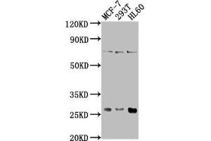 Western Blot Positive WB detected in: MCF-7 whole cell lysate, 293T whole cell lysate, HL60 whole cell lysate All lanes: STYX antibody at 1:1000 Secondary Goat polyclonal to rabbit IgG at 1/50000 dilution Predicted band size: 26 kDa Observed band size: 26 kDa (STYX 抗体  (AA 1-223))