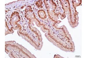 Paraformaldehyde-fixed, paraffin embedded mouse small intestine, Antigen retrieval by boiling in sodium citrate buffer (pH6. (SLC38A2 抗体  (AA 21-150))