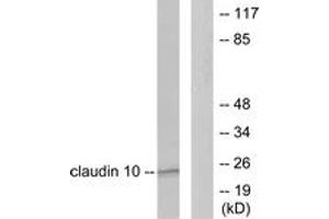 Western blot analysis of extracts from LOVO cells, using Claudin 10 Antibody. (CLDN10 抗体  (AA 179-228))