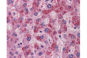 Anti-FGF21 antibody IHC of human liver. (FGF21 抗体  (N-Term))
