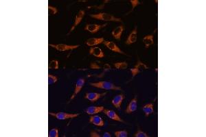 Immunofluorescence analysis of L929 cells using SM antibody (ABIN7270612) at dilution of 1:100. (SMAP1 抗体  (AA 180-250))
