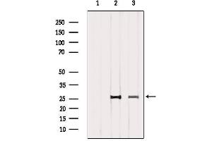 Western blot analysis of extracts from various samples, using CD81 Antibody. (CD81 抗体  (Internal Region))