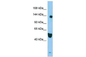 Host: Rabbit Target Name: RASAL2 Sample Type: HepG2 Whole Cell lysates Antibody Dilution: 1. (RASAL2 抗体  (N-Term))