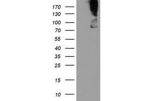 Western Blotting (WB) image for anti-Zinc Finger, BED-Type Containing 1 (ZBED1) antibody (ABIN1501794) (ZBED1 抗体)