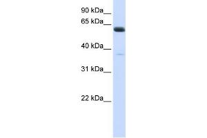 Human Heart; WB Suggested Anti-ALG6 Antibody Titration: 0.