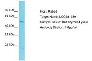 Image no. 1 for anti-VPS33B Interacting Protein, Apical-Basolateral Polarity Regulator (VIPAR) (AA 101-150) antibody (ABIN6750389) (VIPAR 抗体  (AA 101-150))