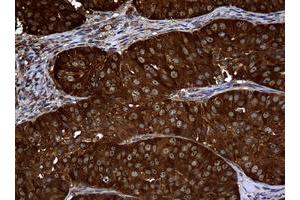 Image no. 1 for anti-Non-Metastatic Cells 1, Protein (NM23A) Expressed in (NME1) antibody (ABIN1499754) (NME1 抗体)