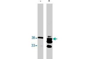 Western blot analysis using PPAP2B polyclonal antibody  on bacterially expressed PPAP2B protein when untreated (-) and treated with with 0. (PPAP2B 抗体)