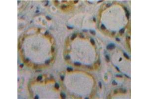 Used in DAB staining on fromalin fixed paraffin-embedded Kidney tissue (CD59 抗体  (AA 26-102))