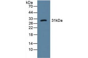 Detection of LOX1 in Human Urine using Polyclonal Antibody to Lectin Like Oxidized Low Density Lipoprotein Receptor 1 (LOX1) (OLR1 抗体  (AA 81-273))