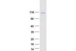 Western Blotting (WB) image for SH3 Domain Containing Ring Finger 1 (SH3RF1) protein (Myc-DYKDDDDK Tag) (ABIN2731980)