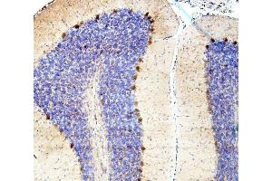 IHC analysis of SMAD2 using anti-SMAD2 antibody (ABIN6719361). (SMAD2 抗体  (AA 83-264))