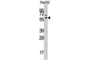Western blot analysis of GRK7 polyclonal antibody  in HepG2 cell line lysates (35 ug/lane). (GRK7 抗体  (C-Term))