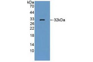 Detection of Recombinant PTPRQ, Human using Polyclonal Antibody to Protein Tyrosine Phosphatase Receptor Type Q (PTPRQ) (PTPRQ 抗体  (AA 36-294))