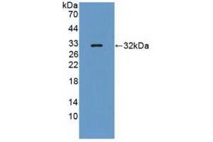 Western Blotting (WB) image for anti-Protein Tyrosine Phosphatase, Receptor Type, Q (PTPRQ) (AA 36-294) antibody (ABIN7442573)