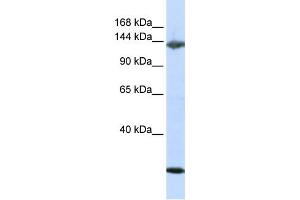 Western Blotting (WB) image for anti-Jagged 2 (JAG2) antibody (ABIN2458924) (JAG2 抗体)