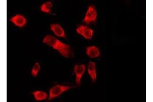 ABIN6278603 staining HeLa by IF/ICC. (OR1D4/5 抗体)