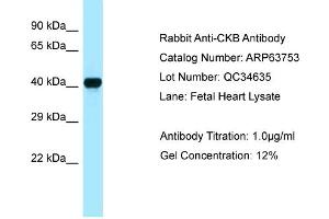 Western Blotting (WB) image for anti-Creatine Kinase, Brain (CKB) (C-Term) antibody (ABIN970402) (CKB 抗体  (C-Term))