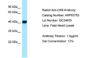 Western Blotting (WB) image for anti-Creatine Kinase, Brain (CKB) (C-Term) antibody (ABIN2789613) (CKB 抗体  (C-Term))