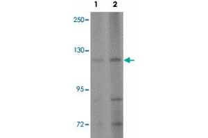 Western blot analysis of AP3B2 in rat brain tissue lysate with AP3B2 polyclonal antibody  at (1) 1 and (2) 2 ug/mL. (AP3B2 抗体  (N-Term))