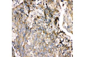 IHC analysis of SHP2/PTPN11 using anti-SHP2/PTPN11 antibody (ABIN3043912).