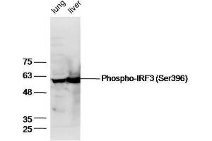 IRF3 抗体  (pSer396)