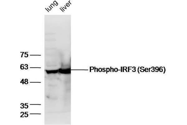 IRF3 抗体  (pSer396)