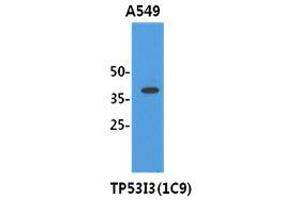 Image no. 1 for anti-Tumor Protein P53 Inducible Protein 3 (TP53I3) (AA 1-332), (N-Term) antibody (ABIN1109287) (TP53I3 抗体  (N-Term))