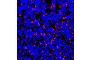 Immunofluorescence of paraffin embedded mouse bone using CSF1 (ABIN7073553) at dilution of 1:900 (400x lens) (M-CSF/CSF1 抗体)