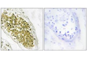 Immunohistochemistry analysis of paraffin-embedded human testis tissue using HIPK4 antibody. (HIPK4 抗体  (C-Term))