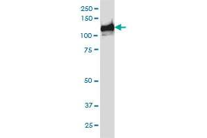 Western Blotting (WB) image for anti-Budding Uninhibited By Benzimidazoles 1 Homolog beta (Yeast) (BUB1B) (AA 1-130) antibody (ABIN560109)