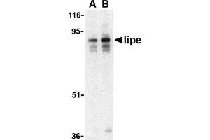 Western Blotting (WB) image for anti-Lipase, Hormone-Sensitive (LIPE) (C-Term) antibody (ABIN1030485) (LIPE 抗体  (C-Term))