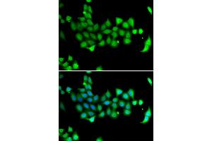Immunofluorescence analysis of A549 cells using HSPA14 antibody. (HSPA14 抗体)