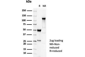 SDS-PAGE Analysis Purified TUBB3 Recombinant Rabbit Monoclonal Antibody (TUBB3/7089R). (Recombinant TUBB3 抗体  (AA 437-450))