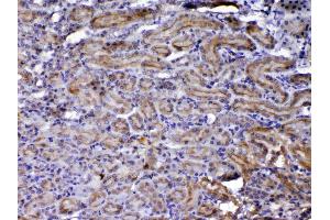 IHC analysis of NOV/CCN3 using anti-NOV/CCN3 antibody . (NOV 抗体  (C-Term))