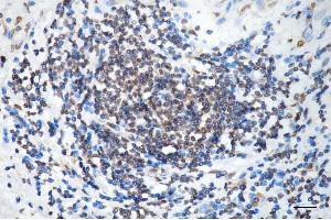 anti-Cold Inducible RNA Binding Protein (CIRBP) antibody