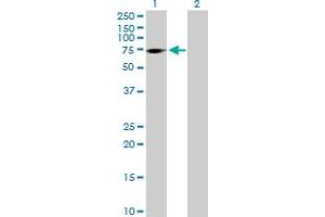 Western Blot analysis of ZNF571 expression in transfected 293T cell line by ZNF571 MaxPab polyclonal antibody. (ZNF571 抗体  (AA 1-609))