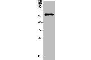 Western Blot analysis of mouse-kidney cells using Antibody diluted at 1000