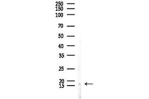 Western blot analysis of lysates from Rat brain, using ME Antibody at 1/1000 dilution. (MED10 抗体  (Internal Region))