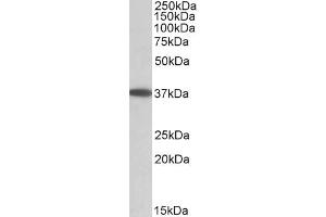 ABIN571230 (0. (MOGAT2 抗体  (Internal Region))