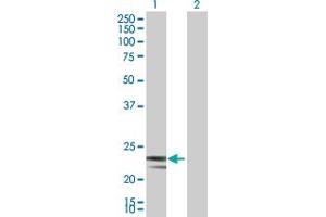 Western Blot analysis of MRPS23 expression in transfected 293T cell line by MRPS23 MaxPab polyclonal antibody. (MRPS23 抗体  (AA 1-190))