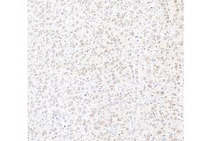 Immunohistochemistry (IHC) image for anti-Mediator Complex Subunit 12 (MED12) (C-Term) antibody (ABIN7453548) (MED12 抗体  (C-Term))